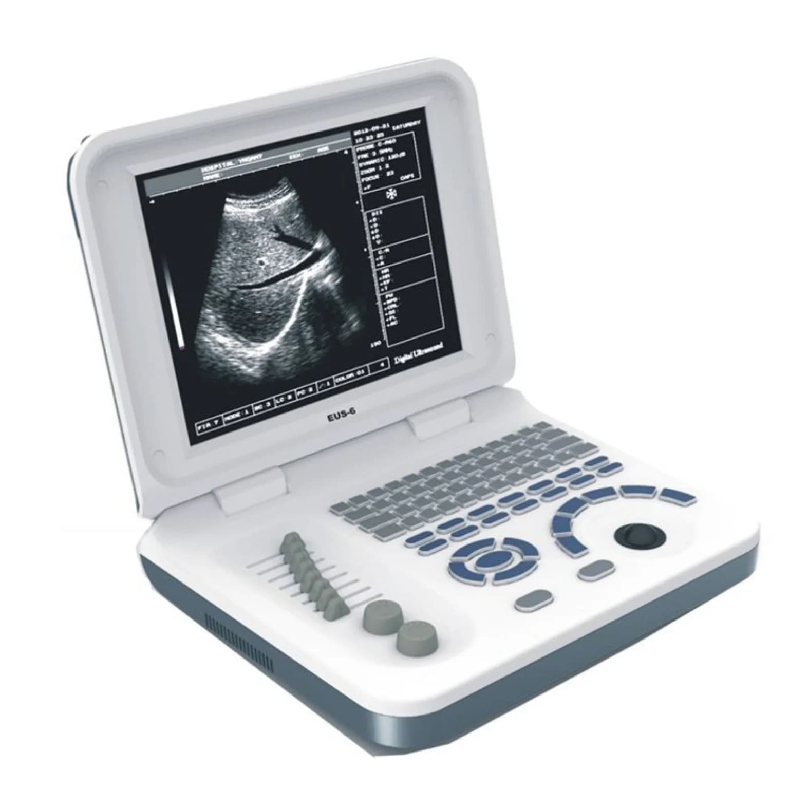 Escáner diagnóstico de ultrasonido LCD portátil veterinario EcoMed EUS-6